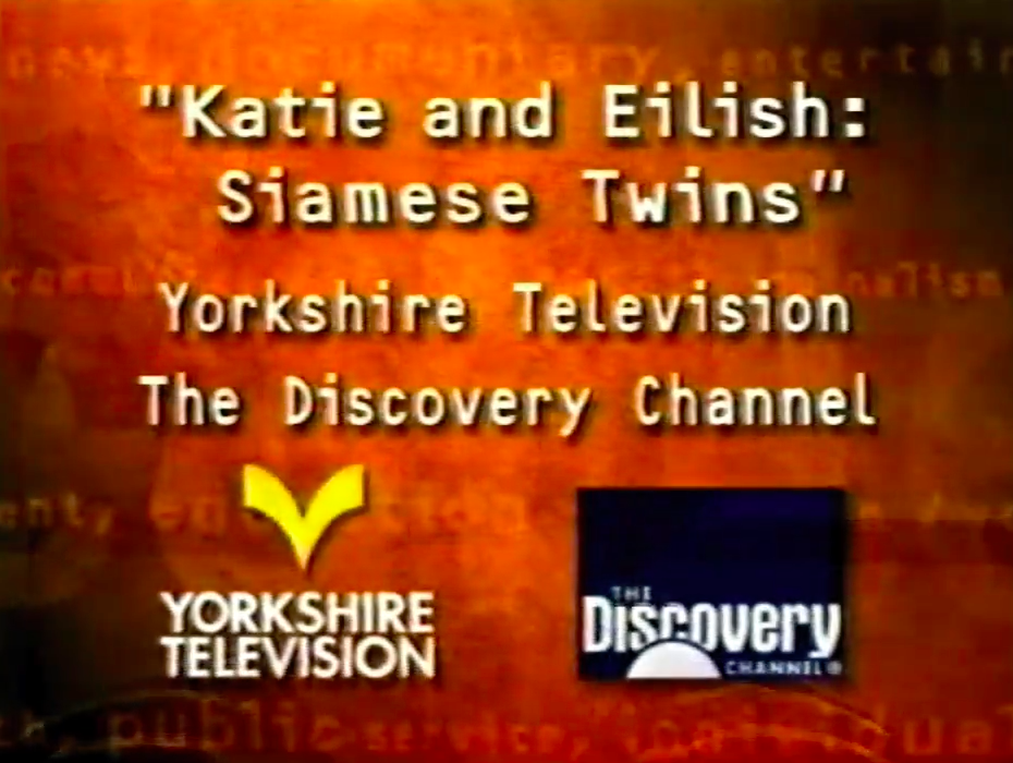 Katie and Eilish Siamese Twins The Peabody Awards